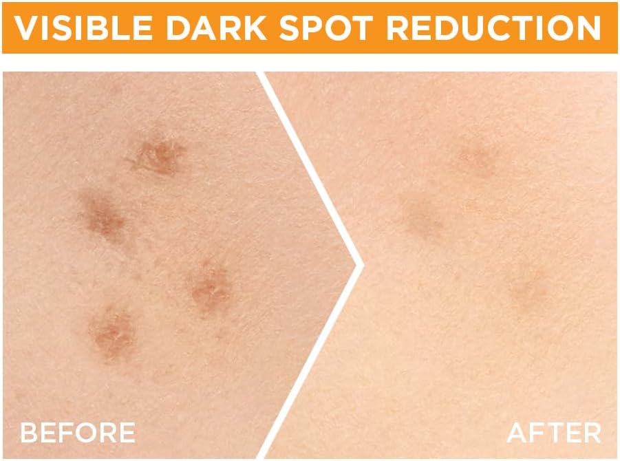 garnier fast bright skinactive vitamin c + niacinamide anti dark spot 30x booster serum 30ml