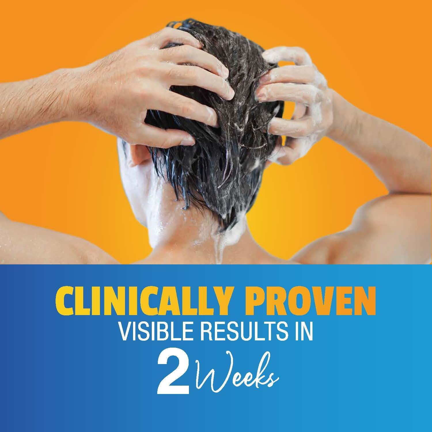 nizoral ketoconazole anti dandruff treatment shampoo, 100 ml, effective dandruff treatment, works from the first wash, clinically proven ketoconazole shampoo to relieve itchy scalp