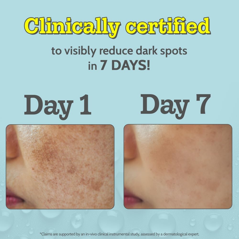 chemist at play 10% vitamin c face serum |brightens & gives glow |fades dark spots |treats hyperpigmentation| balances melanin production | ethyl ascorbic acid & glucosamine | for all skin types 30ml