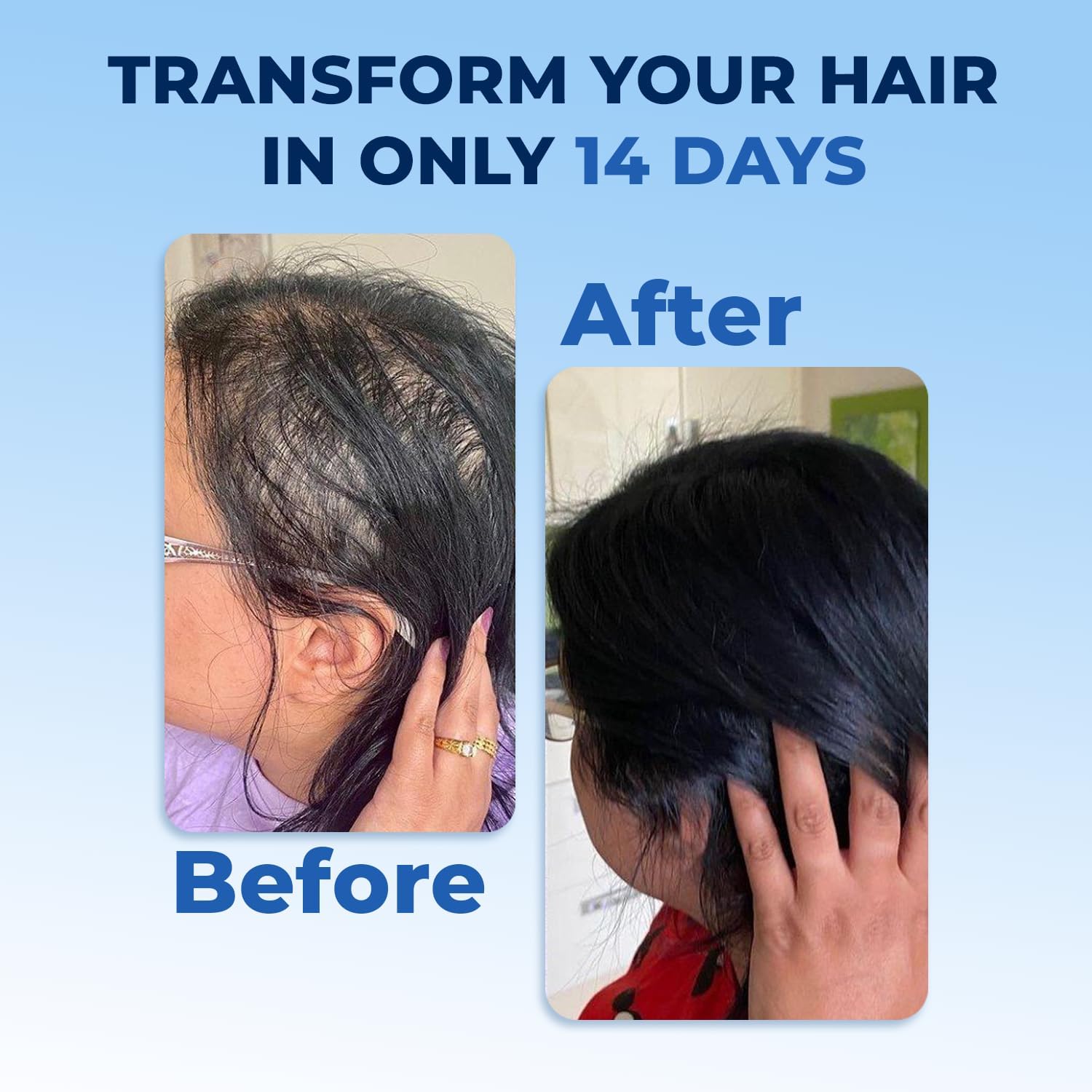 fegplus rosemary beard & hair growth serum (50ml), rosemary extract serum hair spray, rosemary oil for hair growth booster, minoxidil hair fall control, stop hair loss treatment & thicker hair