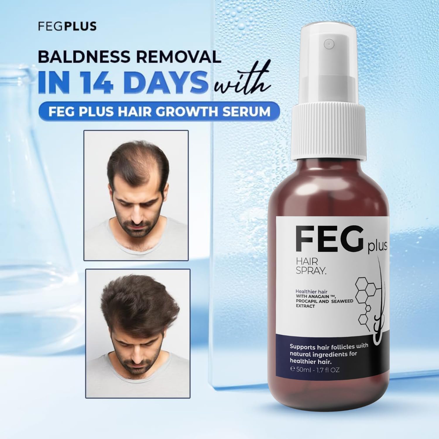 fegplus rosemary beard & hair growth serum (50ml), rosemary extract serum hair spray, rosemary oil for hair growth booster, minoxidil hair fall control, stop hair loss treatment & thicker hair
