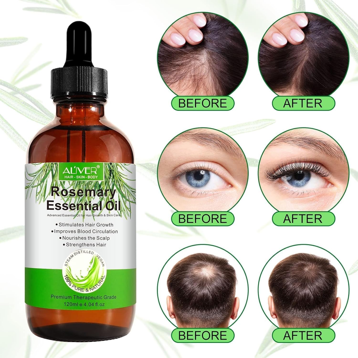 aliver rosemary oil for hair growth (120 ml) with silicone scalp massager, organic rosemary essential oil,rosemary essential oils,100% pure natural,nourishes the scalp,stimulates hair growth