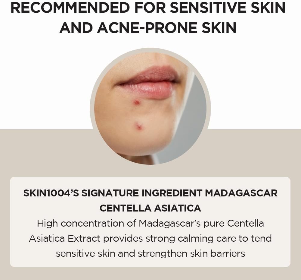 skin1004 madagascar centella asiatica ampoule facial serum 1.01 fl.oz(30ml) | 100% centella asiatica extract for soothing sensitive and acne prone skin (ampoule 100ml)