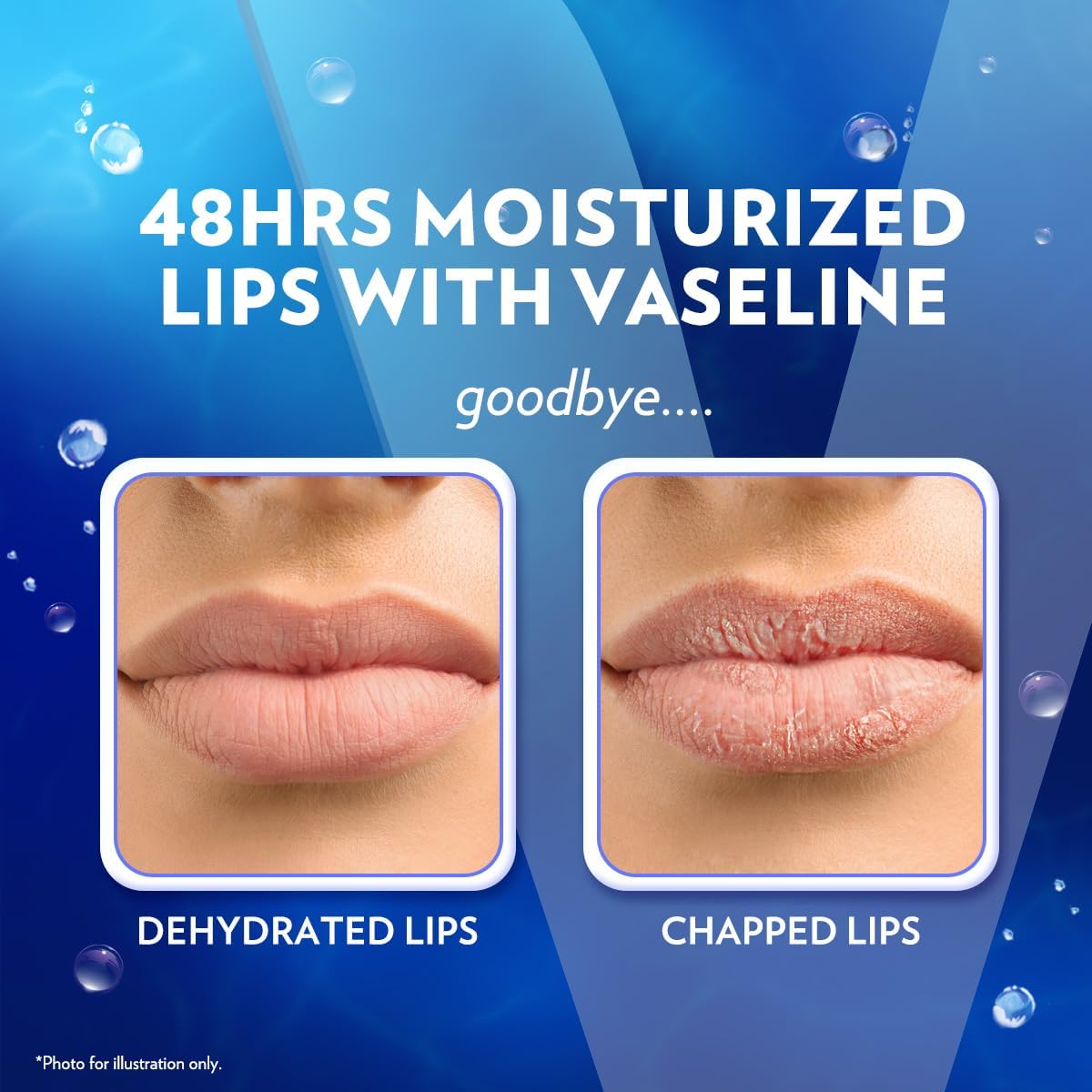 vaseline lip therapy original lip balm with pure jelly & vitamin e for soft & glossy lips| nourishes & protects lips| non greasy lip moisturizer for naturally tinted lips| 4.8 gm