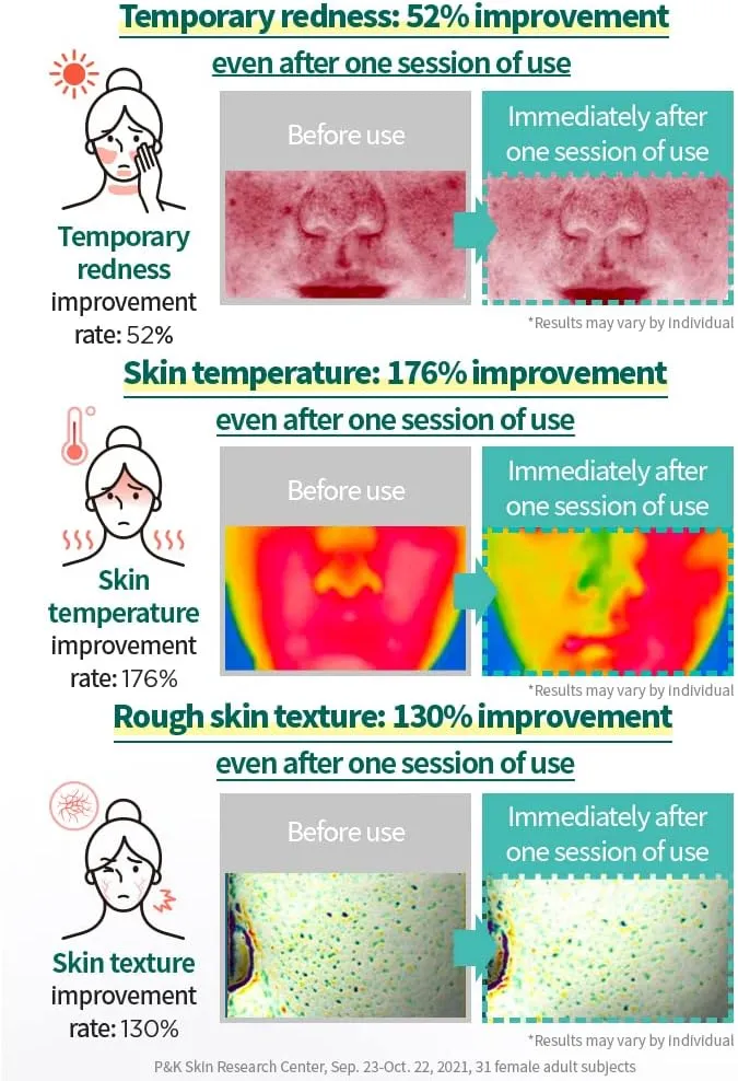 AESTURA A-CICA365 Blemish Calming Face Serum, Niacinamide Serum for Dry and Sensitive Skin, Redness Relief for Acne, Minimize Blemishes, 1.35 Fl Oz (40ml)