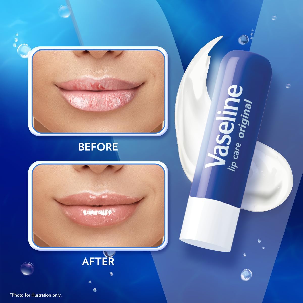 vaseline lip therapy original lip balm with pure jelly & vitamin e for soft & glossy lips| nourishes & protects lips| non greasy lip moisturizer for naturally tinted lips| 4.8 gm