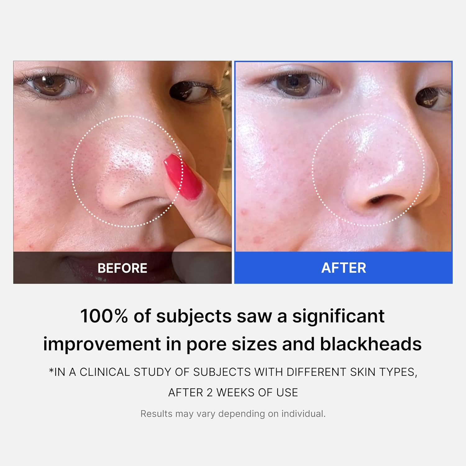 medicube zero pore pad 2.0 | 70 sheets | aha+bha pore + acne care | gentle exfoliating & peeling | no sulfates & parabens