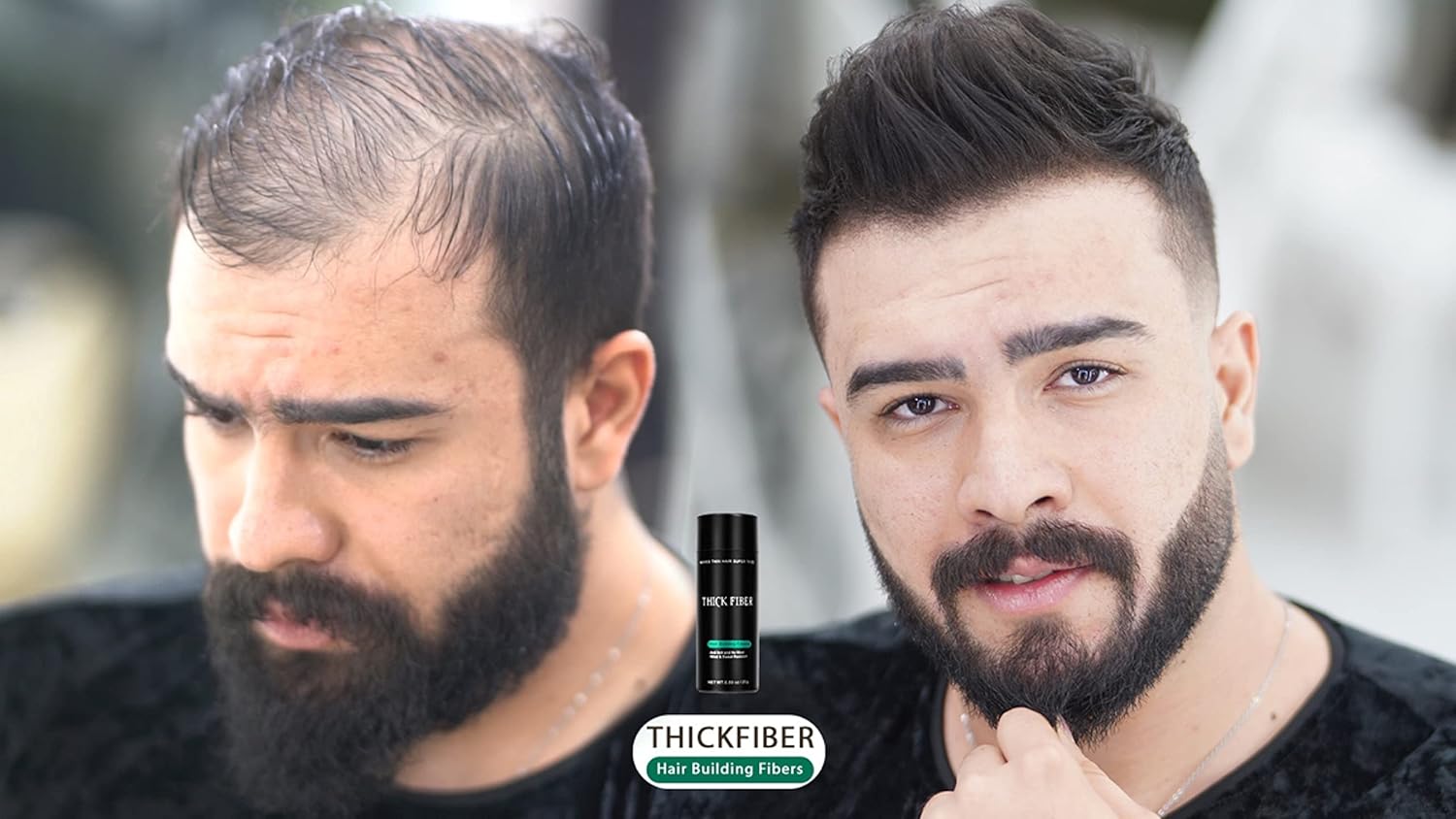 thick fiber hair fibers for thinning hair (black) 25g bottle, hair loss concealer for men & women