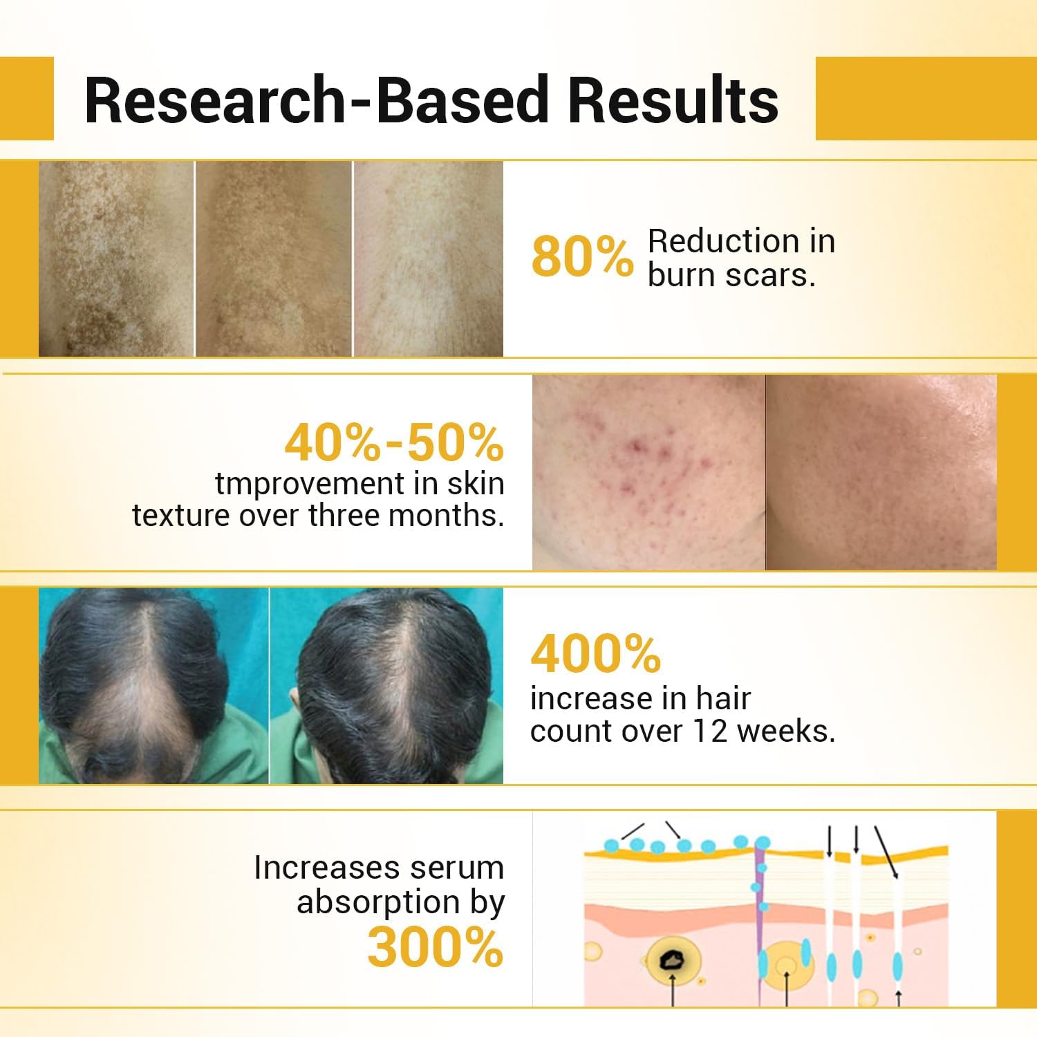 sotrue professional derma roller for hair growth 1 mm with 192 stainless steel needles | repairs damaged hair, activates hair follicles | for hair fall & hair thickening | reduces acne scars | safe &