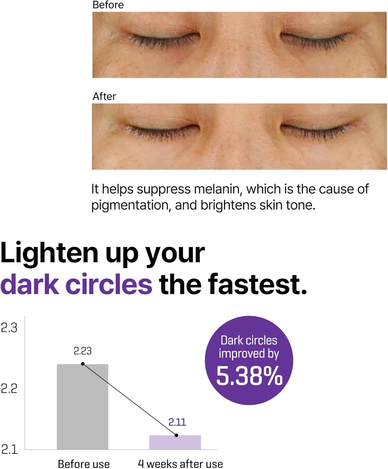 some by mi retinol intense advanced triple action eye cream | mild overnight korean anti aging eye cream | for dark circles & fine lines | ideal for retinol beginners | 1.01oz, 30ml