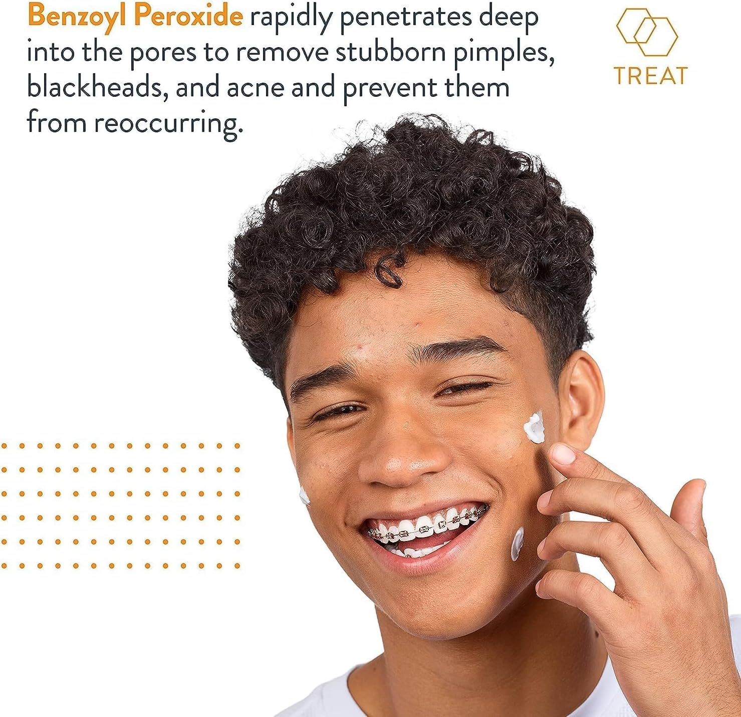 acnefree terminator 10 acne spot treatment with benzoyl peroxide 10% maximum strength acne cream treatment, 1 ounce pack of 1