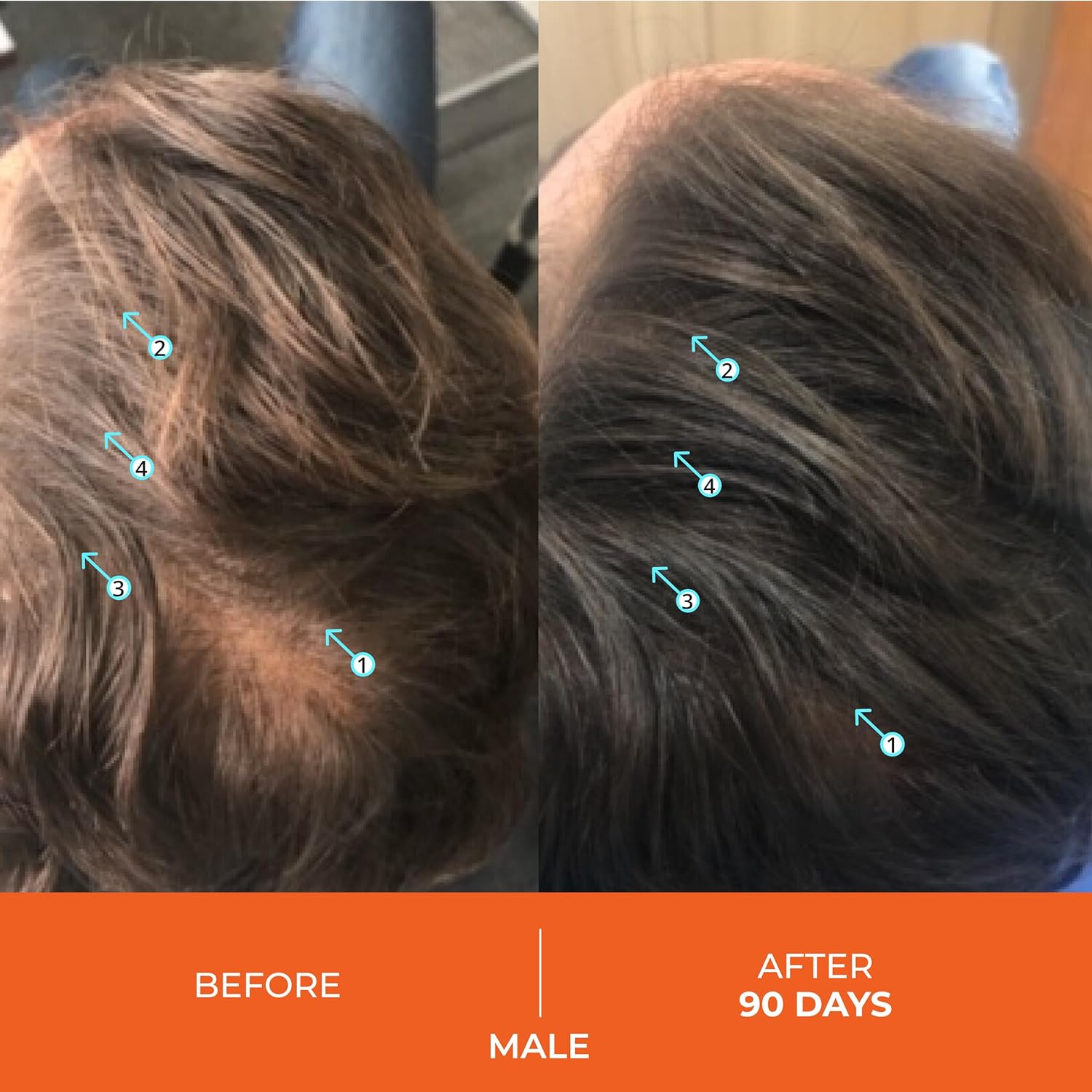 revita shampoo and conditioner for thinning hair by ds laboratories volumizing and thickening for men and women, supports hair growth, hair strengthening, sulfate free, dht blocker (205ml)