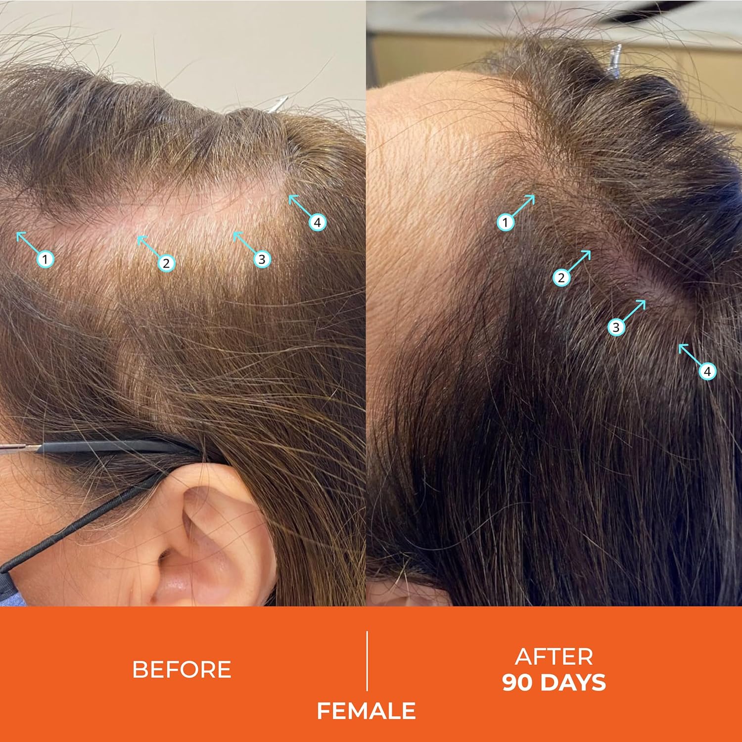 revita shampoo and conditioner for thinning hair by ds laboratories volumizing and thickening for men and women, supports hair growth, hair strengthening, sulfate free, dht blocker (205ml)