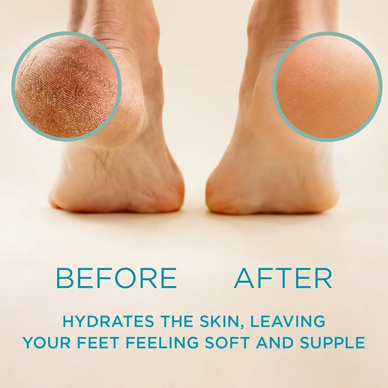 lee beauty professional best callus remover, callus eliminator, liquid & gel for corn and callus on feet, does better job than electric shaver & foot scrubber.