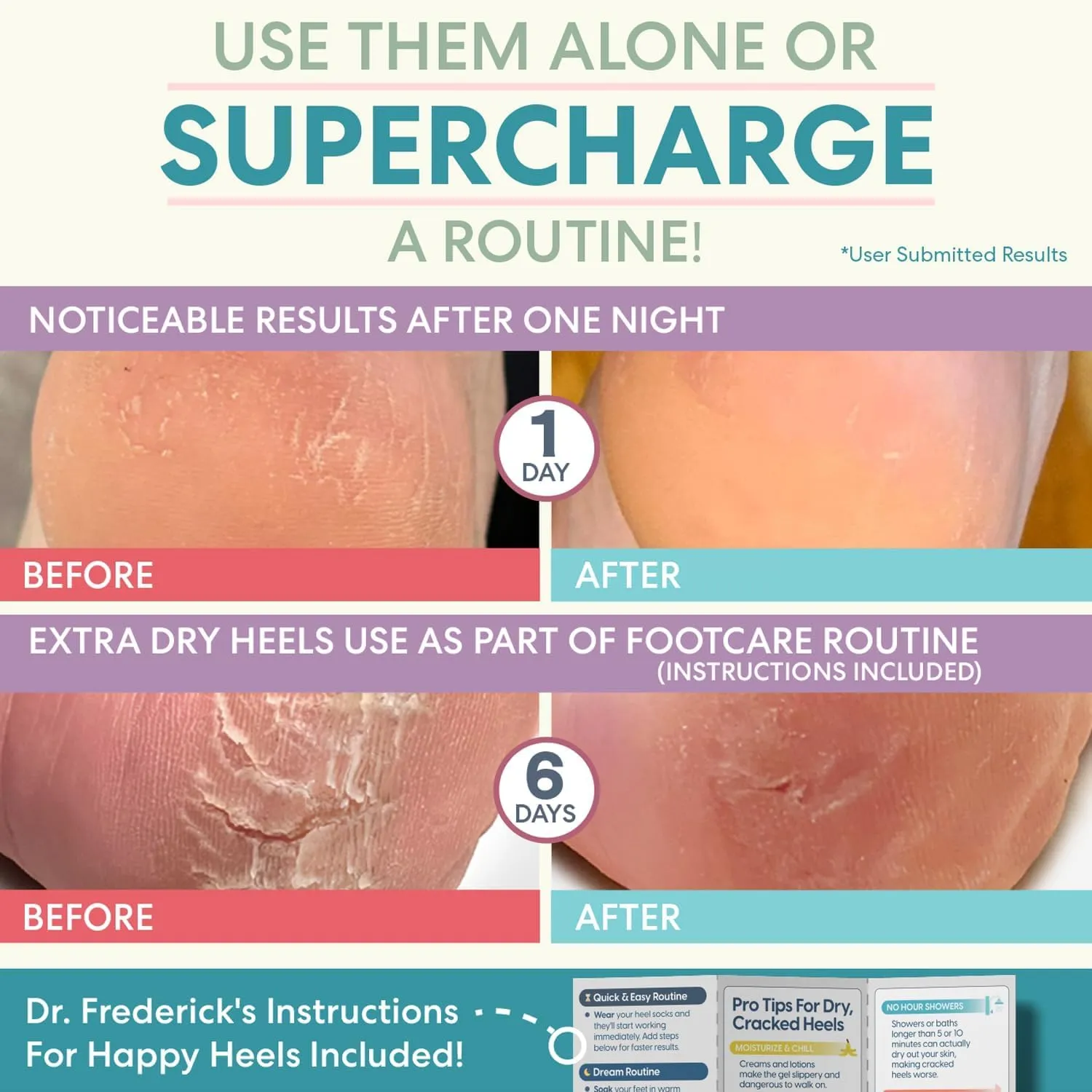 dr. frederick's original moisturizing heel socks for cracked heel treatment 2 pairs stop cracked heels in their tracks