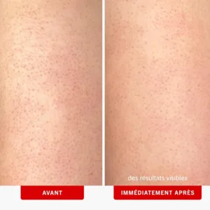 kp bump eraser scrub 3