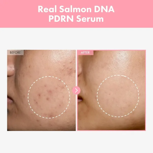 pdrn salmon peptide serum 2