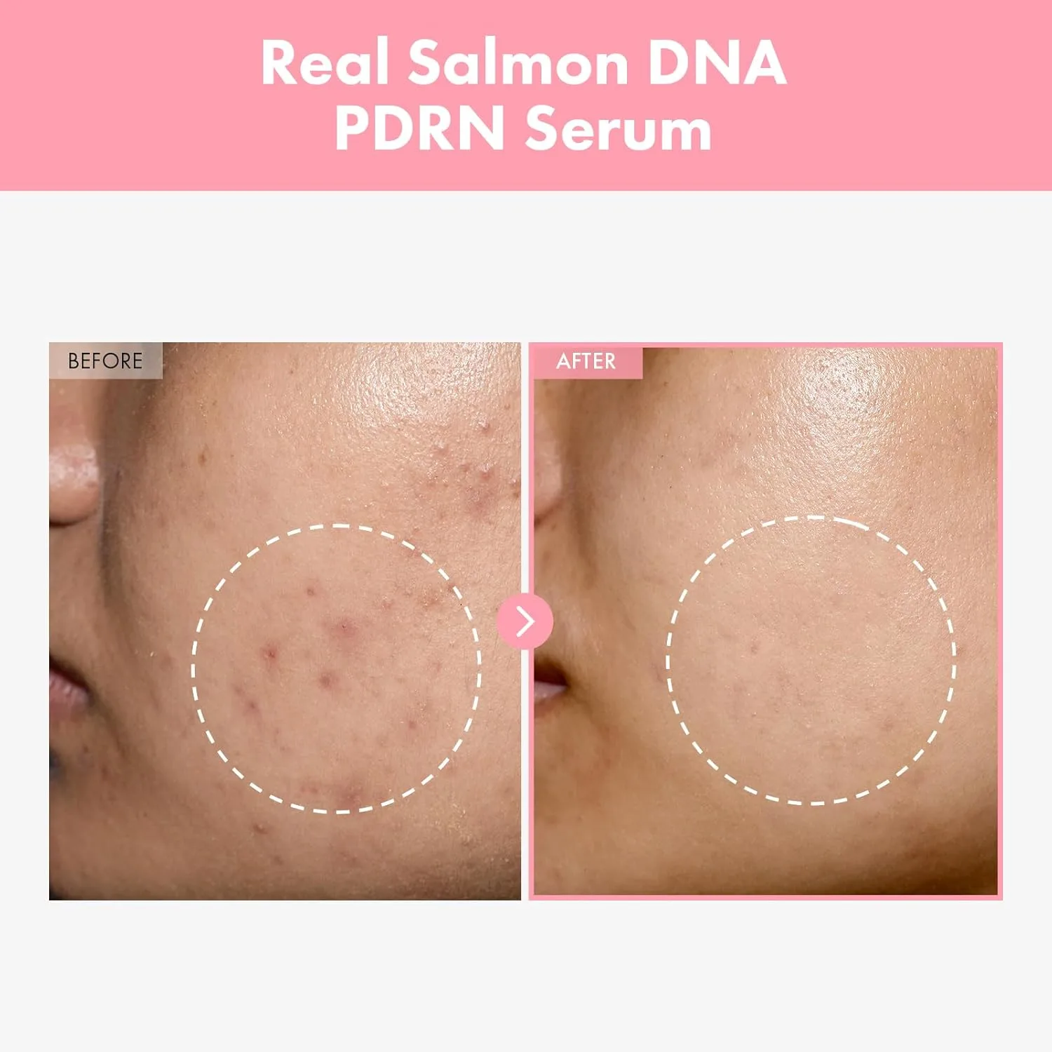 pdrn salmon peptide serum 2