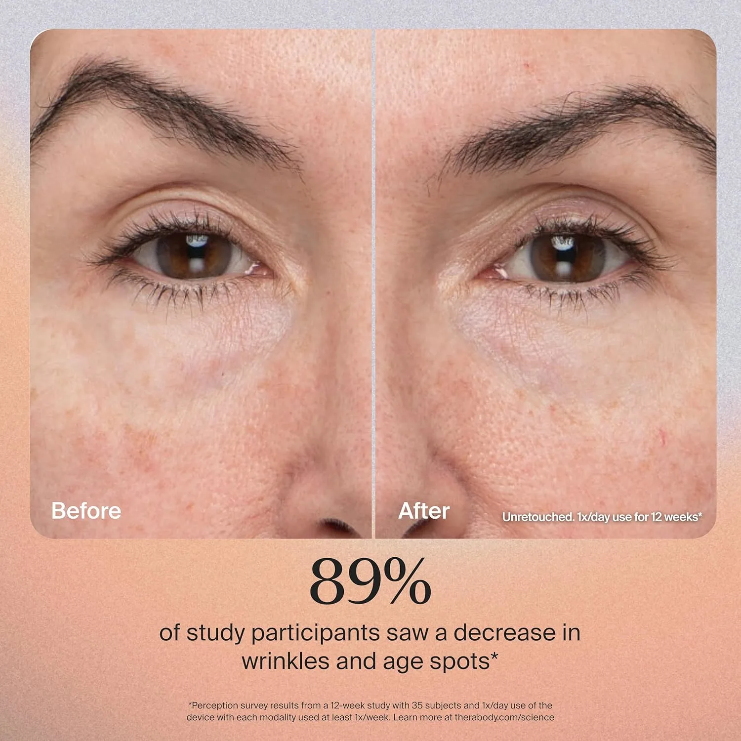 theraface pro facial 3