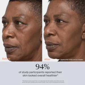 theraface pro facial 4