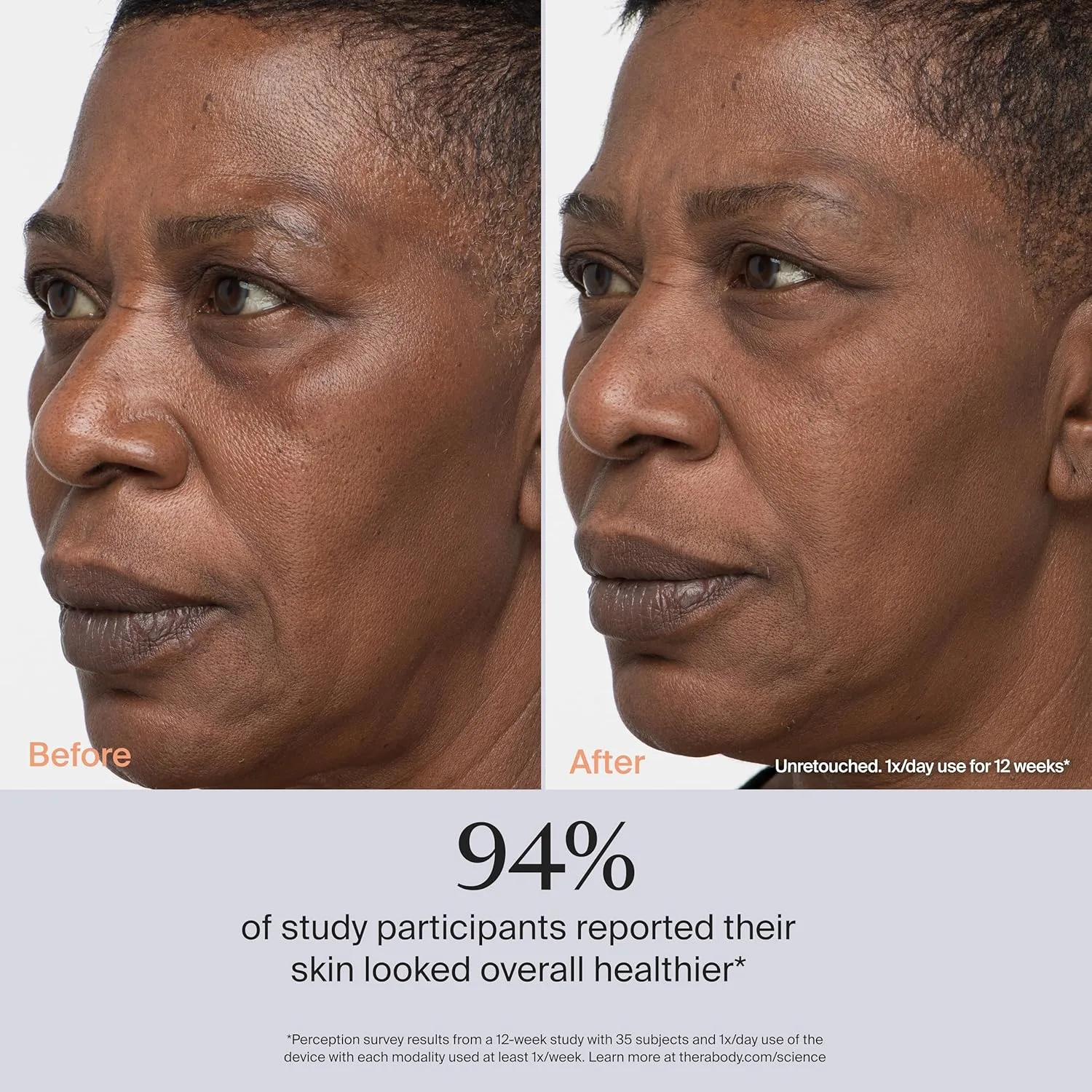 theraface pro facial 4