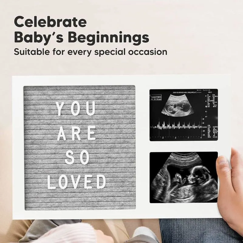 baby picture frame 5