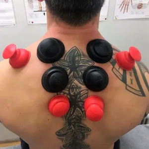 rocktape rockpods cupping 2