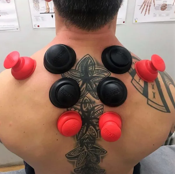 rocktape rockpods cupping 2