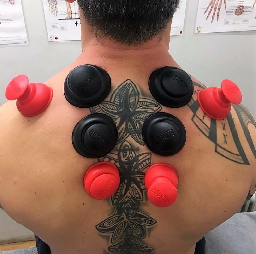 rocktape rockpods cupping 2