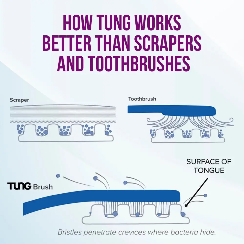 This tongue cleaner starter pack includes the TUNG brush, designed to reach the back of the tongue to eliminate bad breath, and TUNG gel, both made in America and preferred by 90% of users over other tongue cleaners.